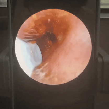 ClearEar™ - Safe Ear Cleaner for Kids & Families